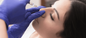 Non-surgical rhinoplasty treatment in Manchester using dermal filler at an aesthetics clinic
