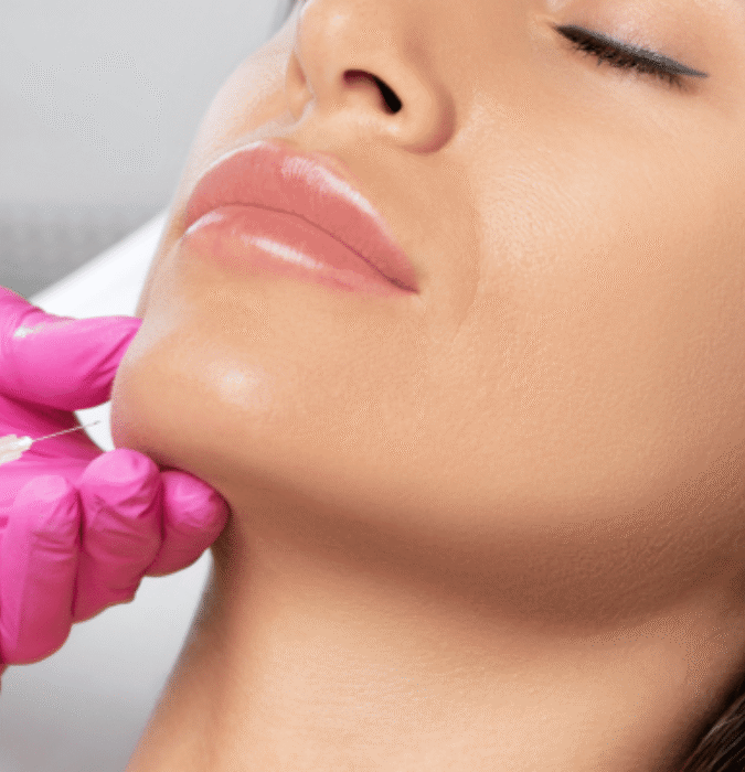Cheek, Chin, and Jawline Augmentation Filler