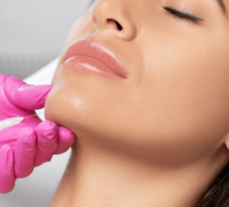 Cheek, Chin, and Jawline Augmentation Filler