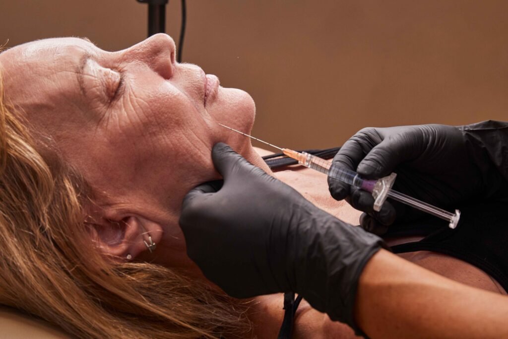 Marionette Lines Filler in Manchester