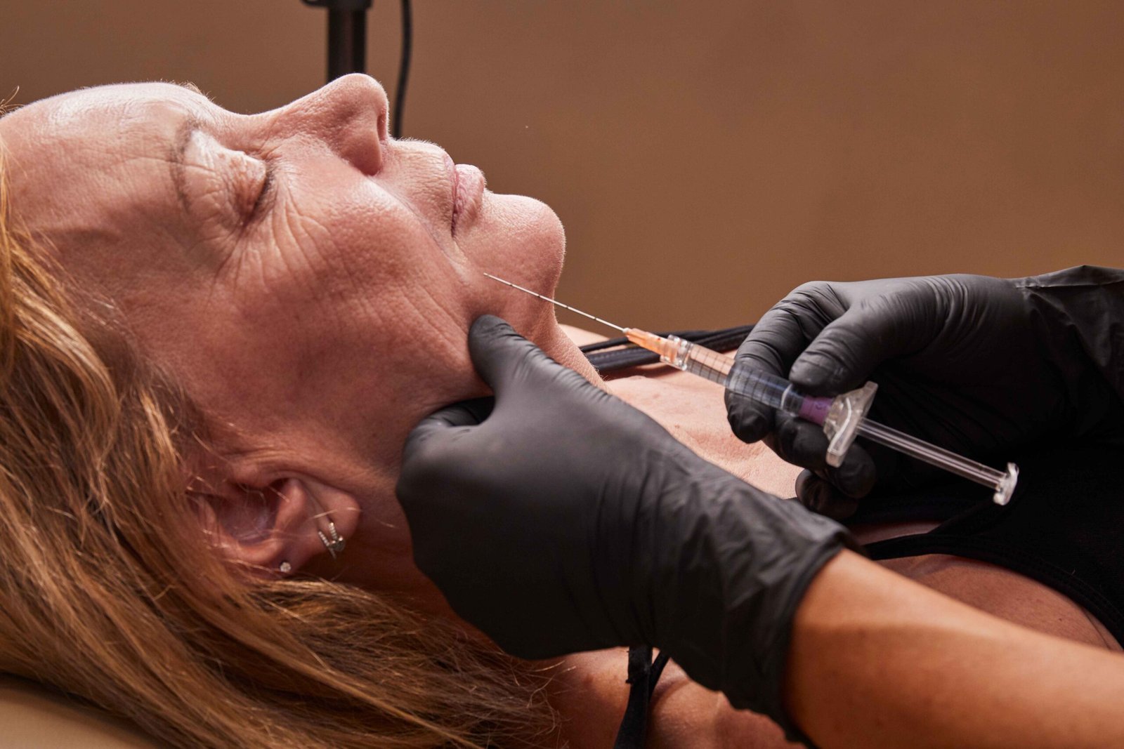 Marionette Lines Filler in Manchester