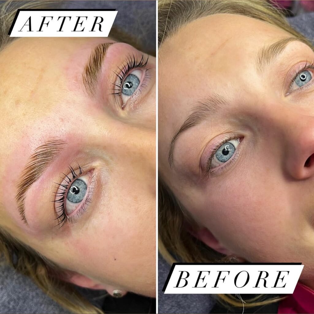 Beautifeye Skin Boosters