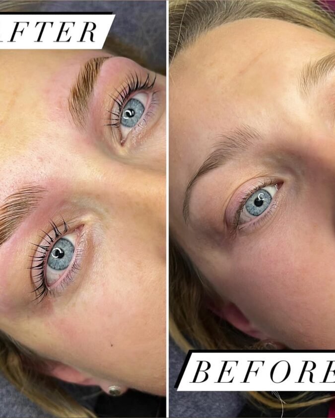 Beautifeye Skin Boosters