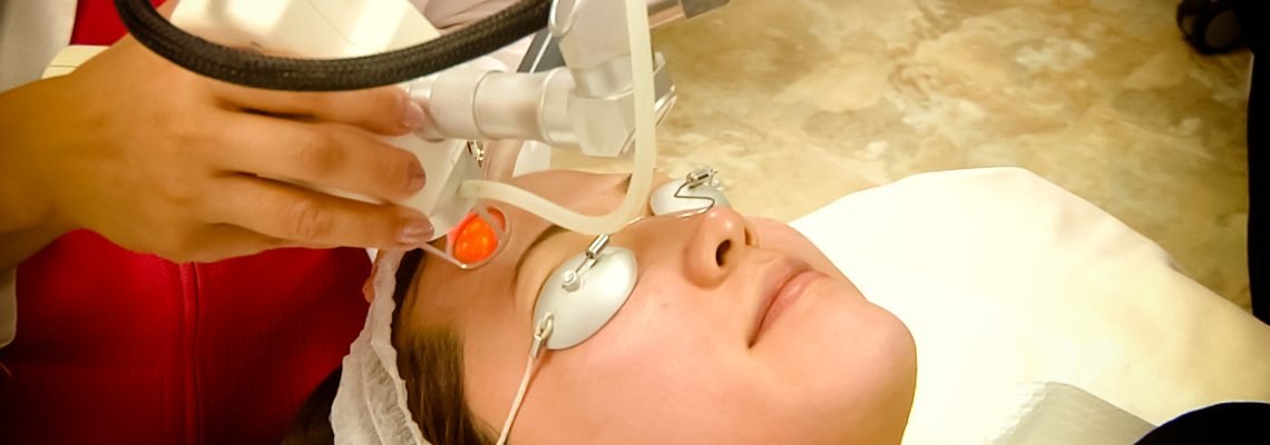 CO2 Facial resurfacing