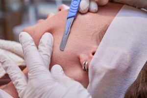 Dermaplaning in Manchester