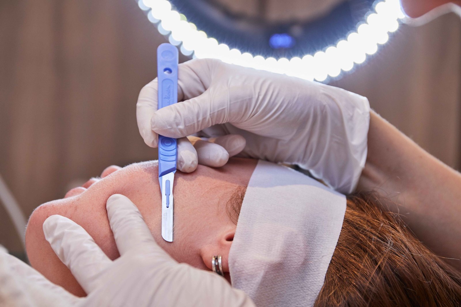 Dermaplaning treatment in Manchester