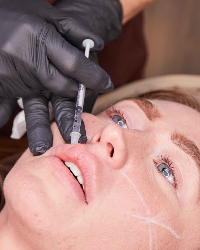 Lip Filler in Manchester