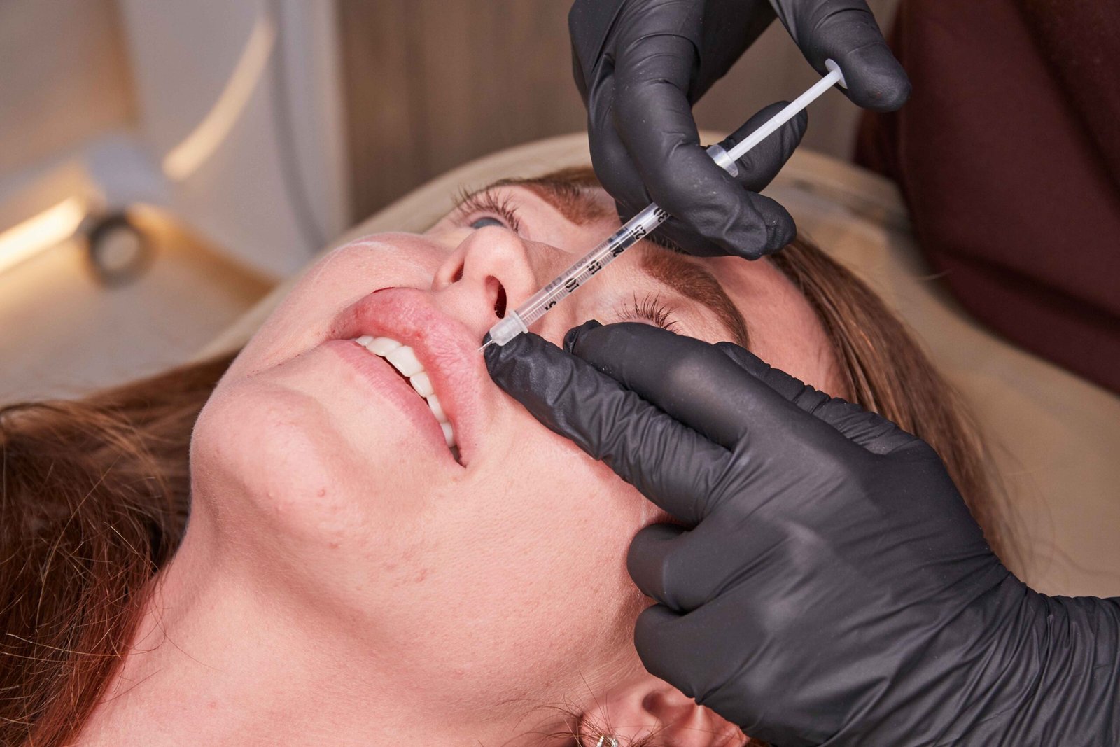 Lip Filler treatment in Manchester