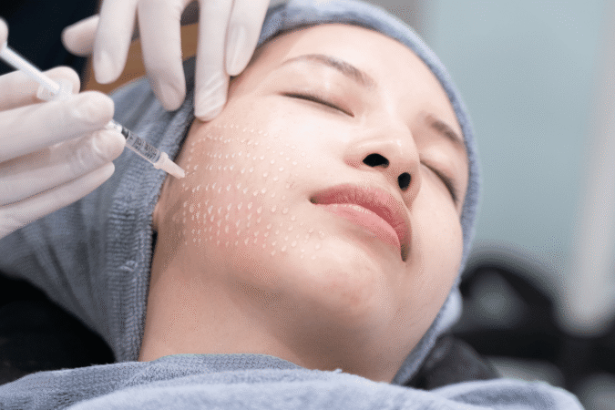 Mesotherapy