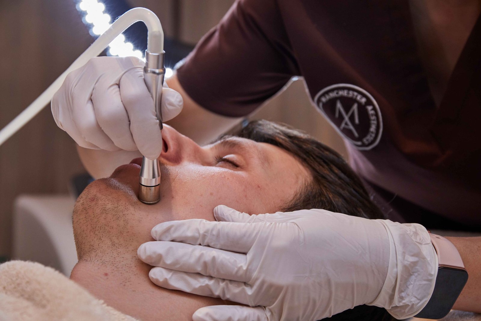 Microdermabrasion in manchester