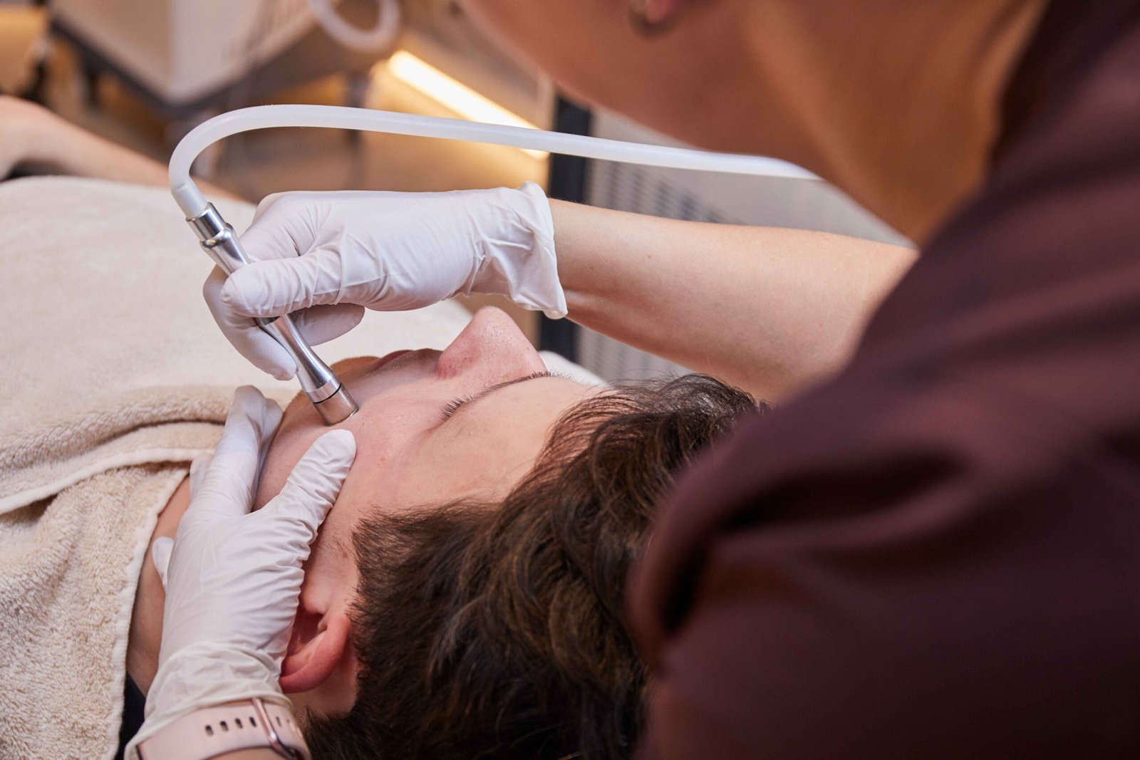 Microdermabrasion Treatment in manchester