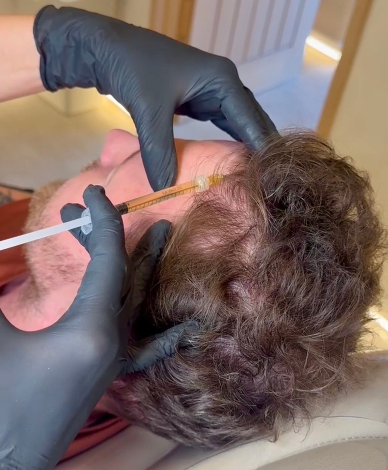 Platelet-Rich Plasma (PRP) Treatment in Manchester