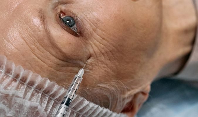 Profhilo Treatment
