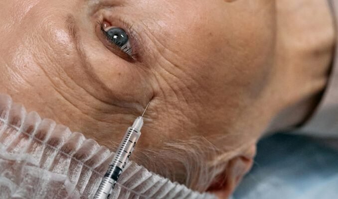 Profhilo Treatment