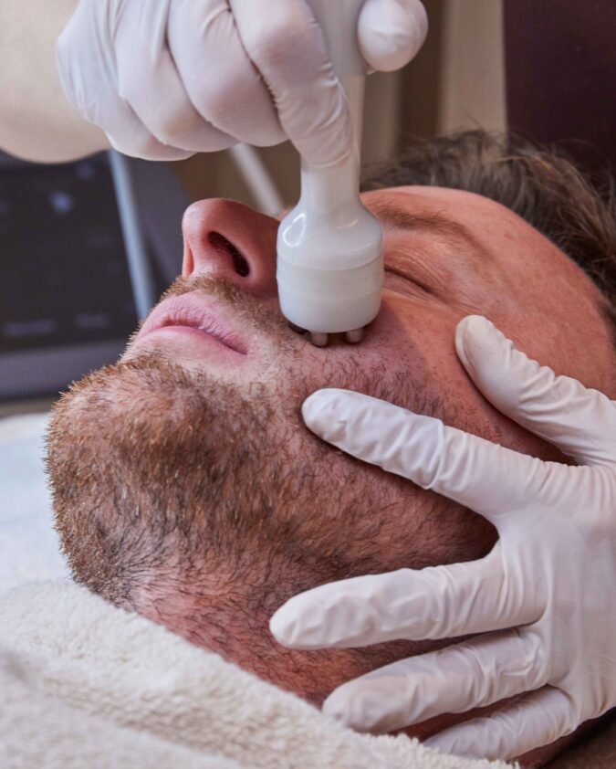 R F Skin Tightening Facial