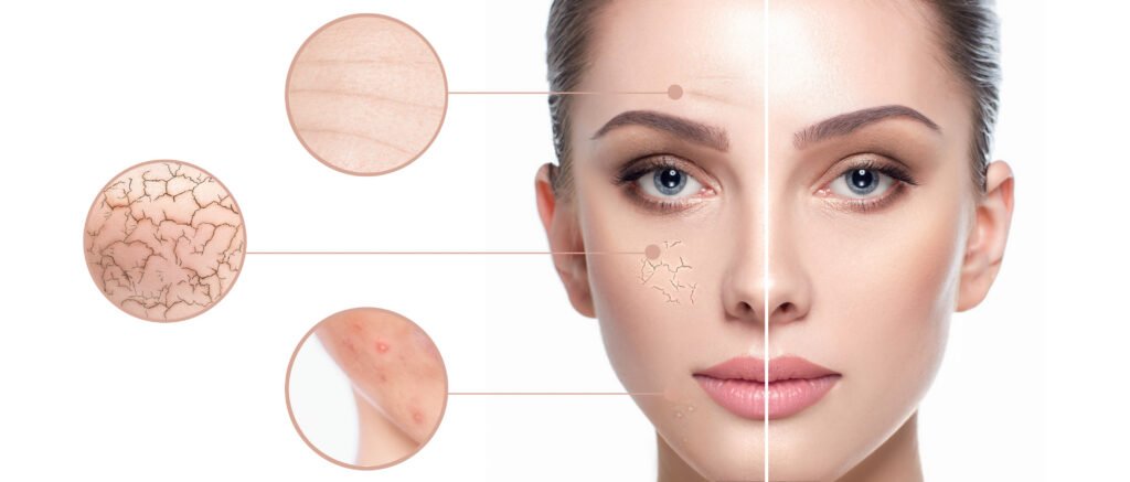 Scar Reduction