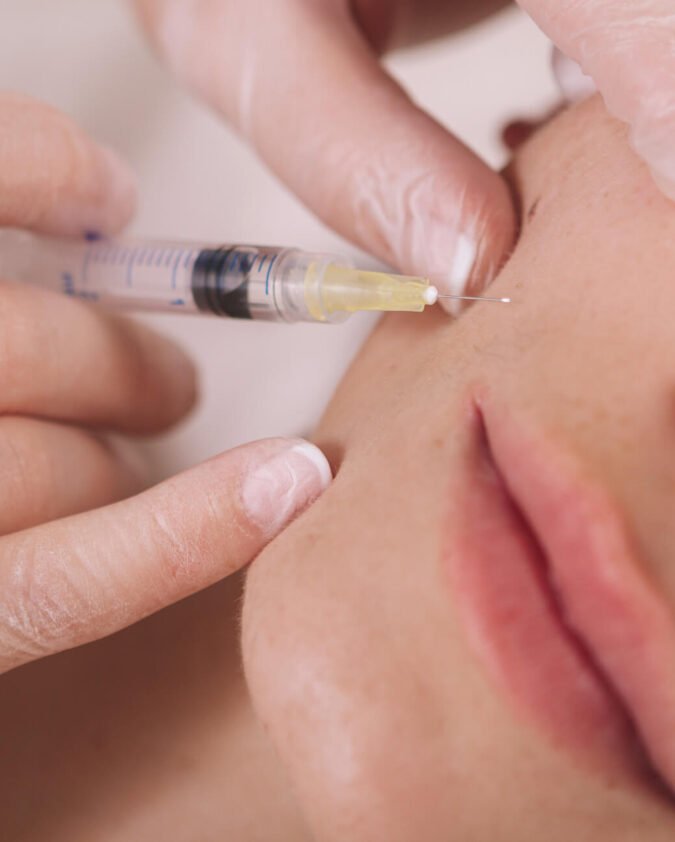 Skin booster treatment in Manchester performed at a professional Manchester aesthetics clinic