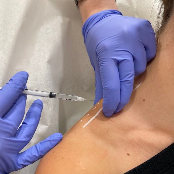 Botox for Trapezius Muscles in Manchester