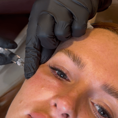 Beautifeye Skin Boosters in Manchester