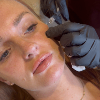 Eye Brightening Treatment in Manchester UK