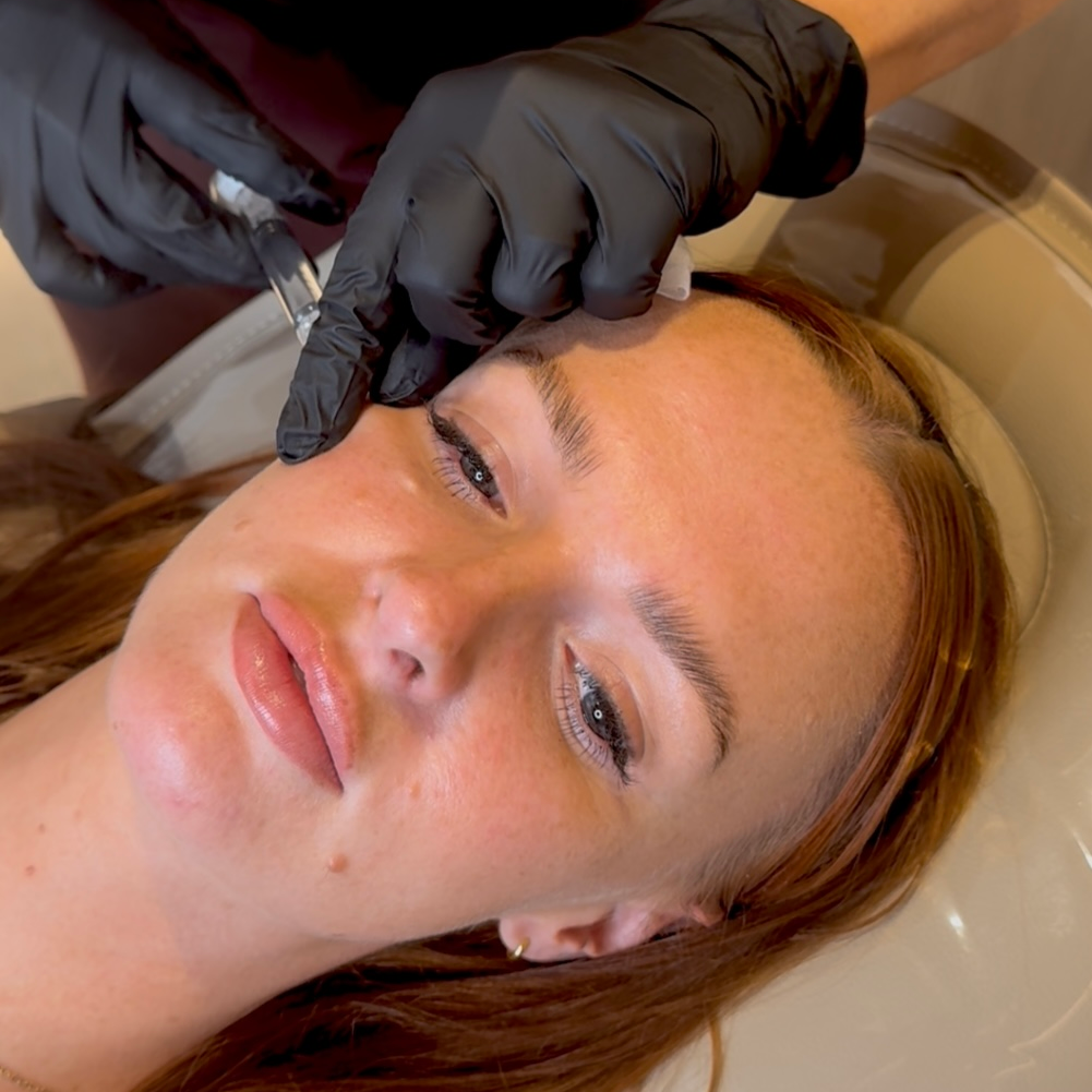 Polynucleotides under-eye treatment in Manchester