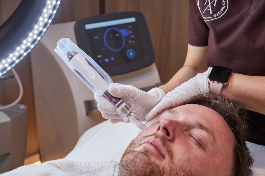 Microneedling in Manchester