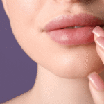 Lip Fillers Affect
