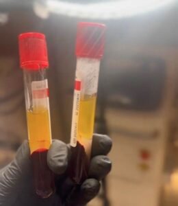 Two blood sample tubes held in a gloved hand