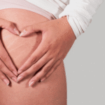 Causes Scars and Stretch Marks