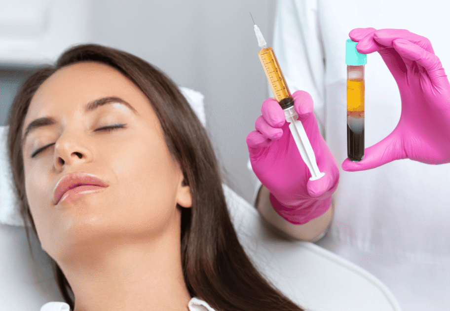 How PRP Helps Reduce Fine Lines, Wrinkles, and Acne Scars 1 PRP Treatment