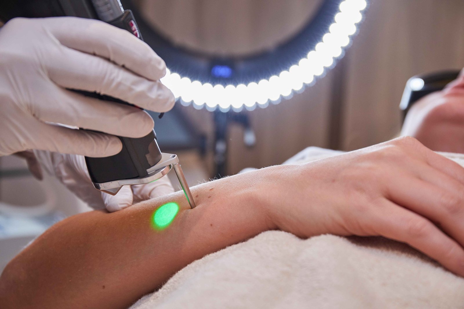Laser Hair Removal for PCOS in Manchester