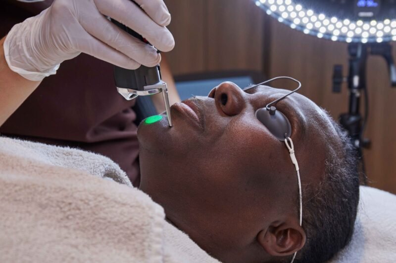 practitioner julie doing laser hair removal for dark sking at manchester aesthetics clinic