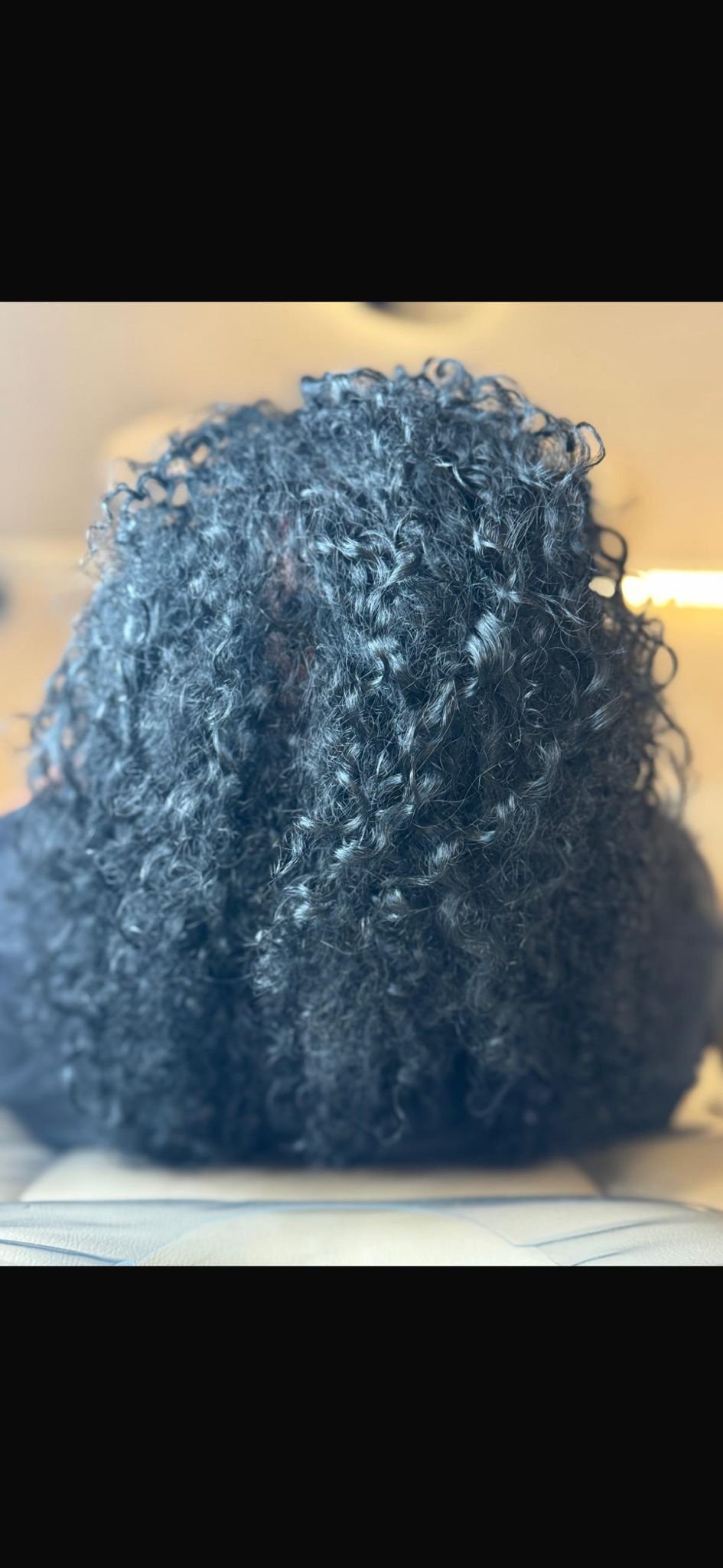 After PRP hair treatment showing improved-looking hair coverage, fuller curls and enhanced hair density.