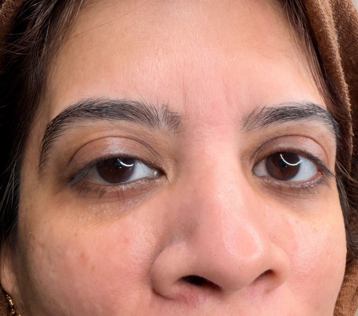 B&A polynucleotides under eye in Manchester