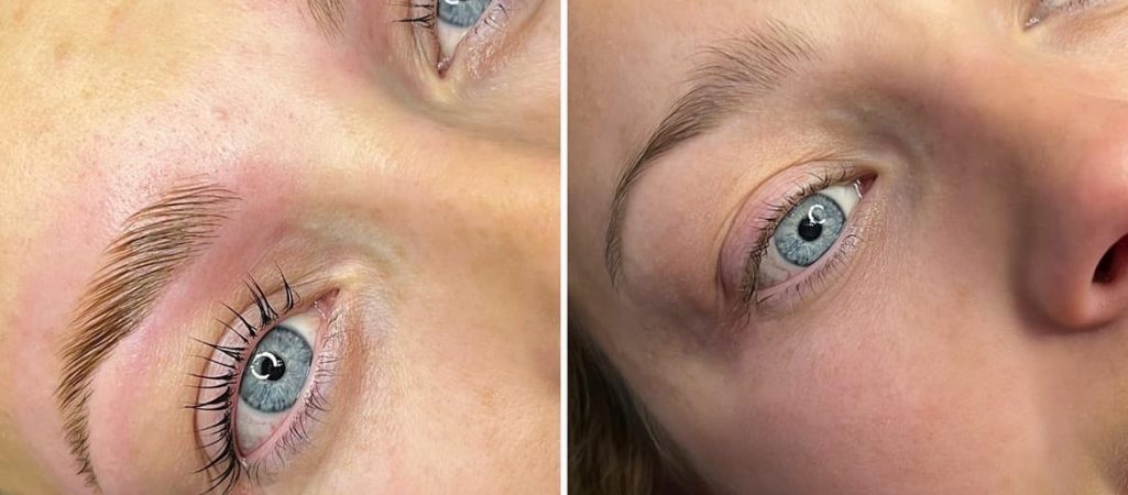 Beautifeye Skin Booster Treatment
