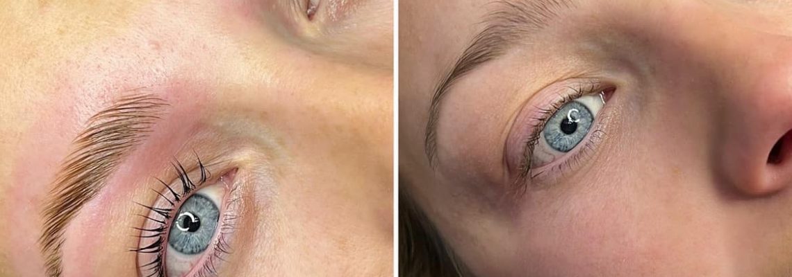 Beautifeye Beautifeye Skin Booster Treatment
