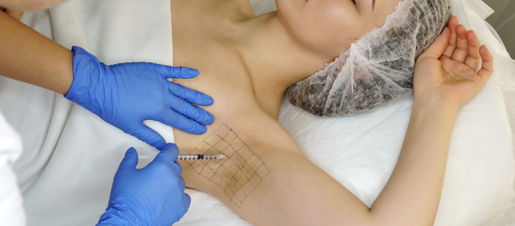 Botox underarm sweating treatment in manchester