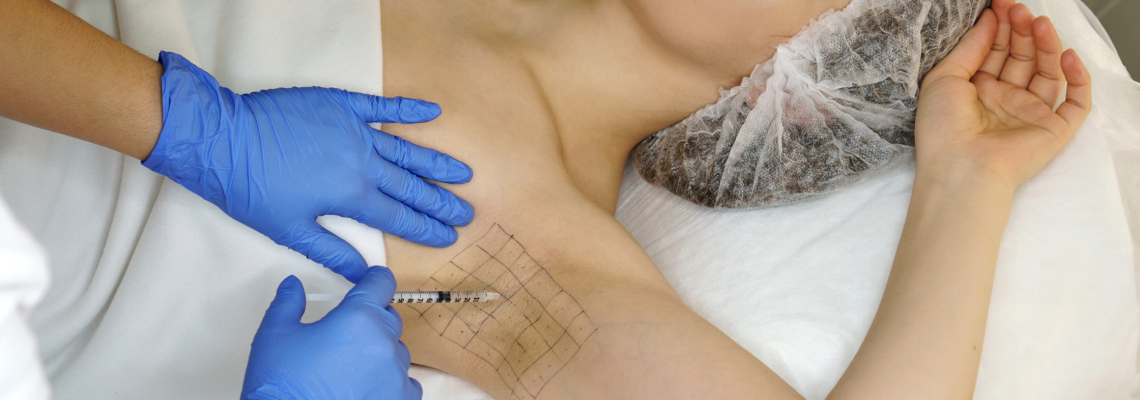 Botox To Reduce Sweating Axilla (Armpits) Botox underarm sweating treatment in manchester