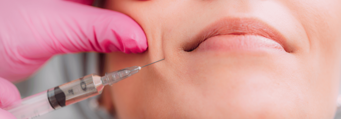 Marionette Lines Filler Treatment Marionette Lines Filler Treatment