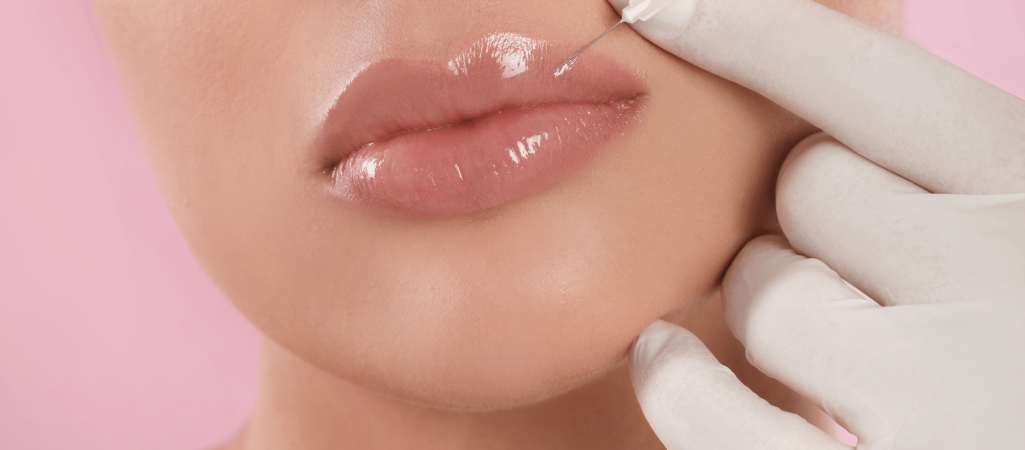 Lip Augmentation Filler