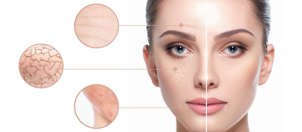scar reduction treatments at Manchester Aesthetics Clinic