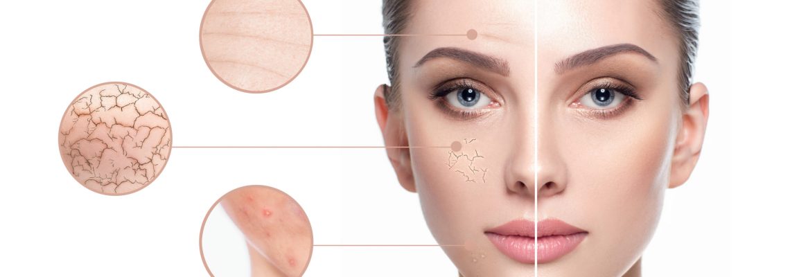 scar reduction treatments scar reduction treatments at Manchester Aesthetics Clinic