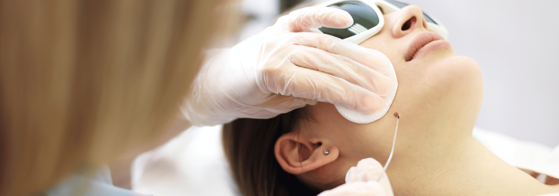 Skin Tag & Wart removal Skin Tag & Wart removal