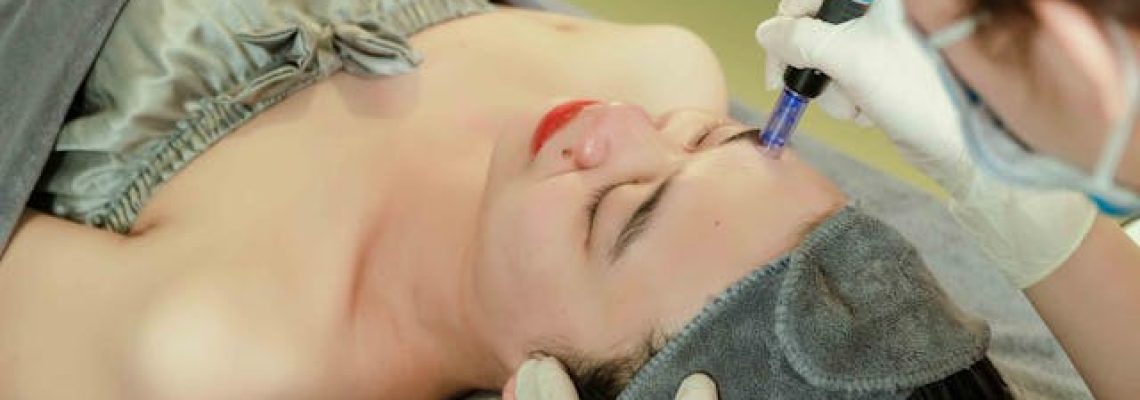 microdermabrasion treatment microdermabrasion treatment
